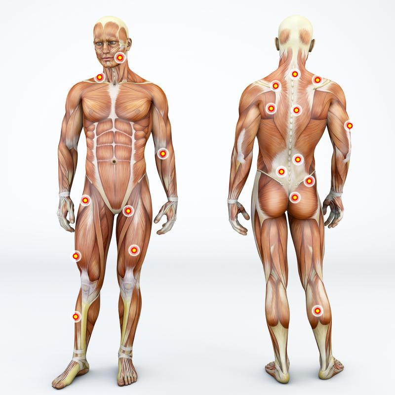 Myofascial trigger points, also known as trigger points, are described as hyperirritable spots in the fascia surrounding skeletal muscle. They are associated with palpable nodules in taut bands of muscle fibers. Front and back view of a man and trigger points. Anatomy muscle man. 3d rendering